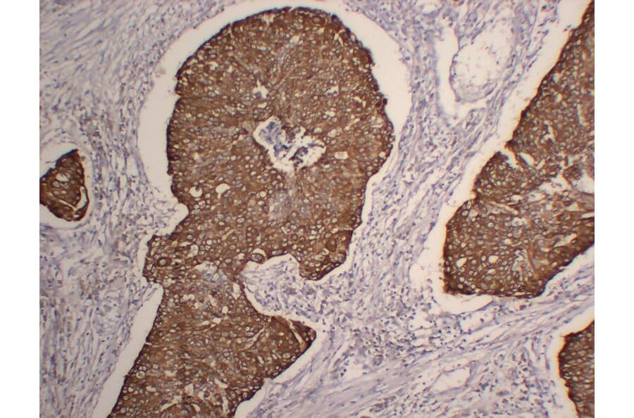 Immunohistochemistry - Anti-Cytokeratin 5 Antibody (V0054) - Antibodies.com