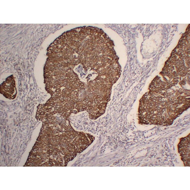 Immunohistochemistry - Anti-Cytokeratin 5 Antibody (V0054) - Antibodies.com