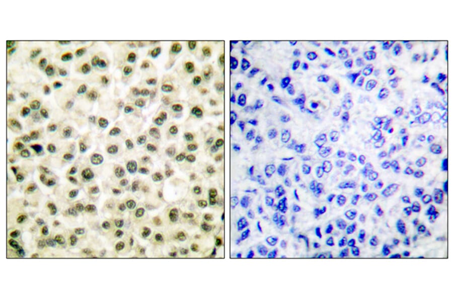 Immunohistochemistry - Anti-Ku70 + Ku80 Antibody (C0252) - Antibodies.com