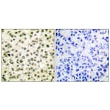 Immunohistochemistry - Anti-Ku70 + Ku80 Antibody (C0252) - Antibodies.com