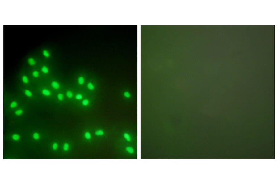 Immunofluorescence - Anti-Ku70 + Ku80 Antibody (C0252) - Antibodies.com