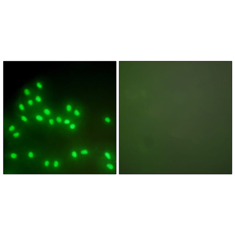 Immunofluorescence - Anti-Ku70 + Ku80 Antibody (C0252) - Antibodies.com