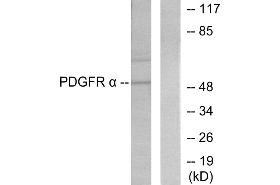 Western Blot - Anti-Peripherin Antibody (C0301) - Antibodies.com