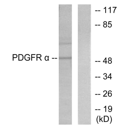 Western Blot - Anti-Peripherin Antibody (C0301) - Antibodies.com