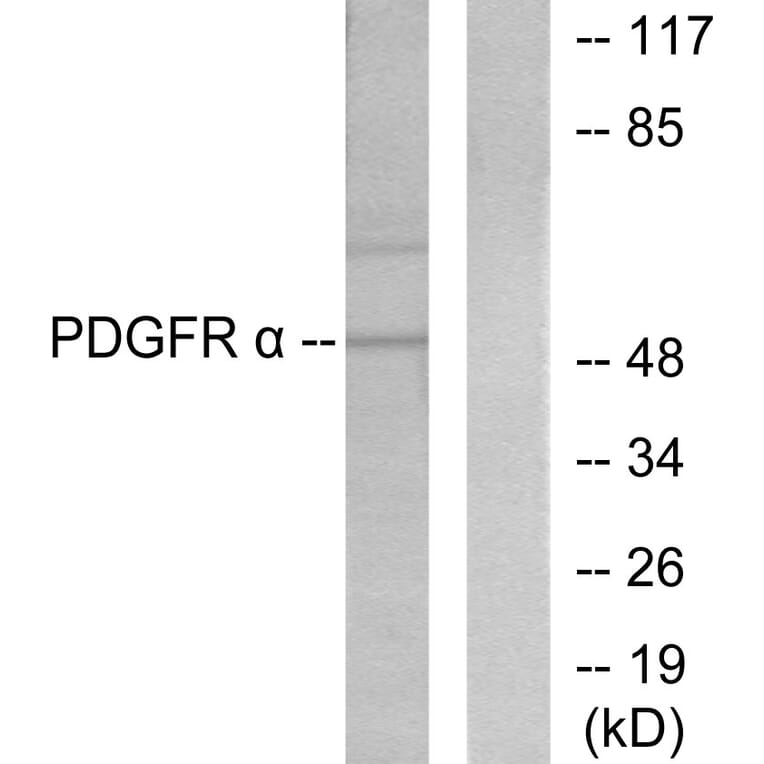 Western Blot - Anti-Peripherin Antibody (C0301) - Antibodies.com