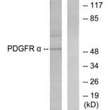 Western Blot - Anti-Peripherin Antibody (C0301) - Antibodies.com