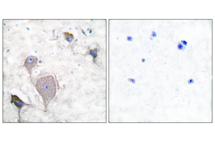 Immunohistochemistry - Anti-Peripherin Antibody (C0301) - Antibodies.com
