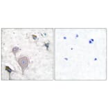 Immunohistochemistry - Anti-Peripherin Antibody (C0301) - Antibodies.com