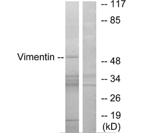 Western Blot - Anti-Vimentin Antibody (B1242) - Antibodies.com