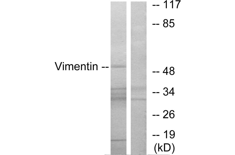 Western Blot - Anti-Vimentin Antibody (B1242) - Antibodies.com