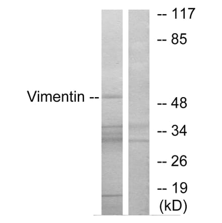 Western Blot - Anti-Vimentin Antibody (B1242) - Antibodies.com