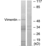 Western Blot - Anti-Vimentin Antibody (B1242) - Antibodies.com