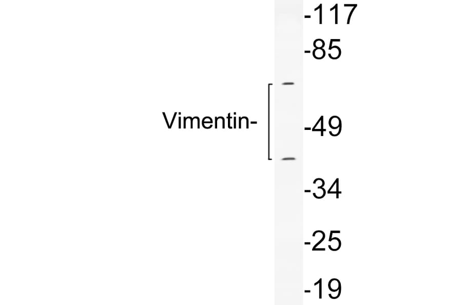 Western Blot - Anti-Vimentin Antibody (R12-2410) - Antibodies.com