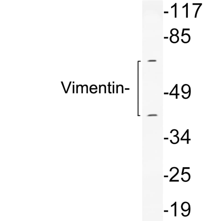 Western Blot - Anti-Vimentin Antibody (R12-2410) - Antibodies.com