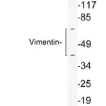 Western Blot - Anti-Vimentin Antibody (R12-2410) - Antibodies.com