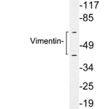 Western Blot - Anti-Vimentin Antibody (R12-2411) - Antibodies.com