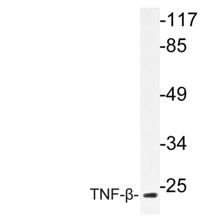 Western Blot - Anti-TNF-beta Antibody (R12-2382) - Antibodies.com