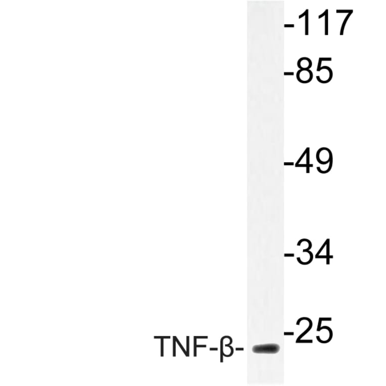 Western Blot - Anti-TNF-beta Antibody (R12-2382) - Antibodies.com