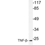 Western Blot - Anti-TNF-beta Antibody (R12-2382) - Antibodies.com