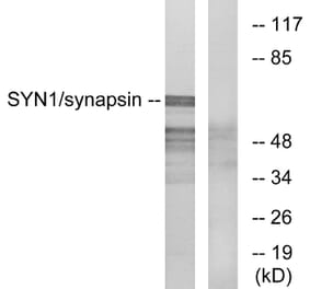 Western Blot - Anti-Synapsin Antibody (B7233) - Antibodies.com