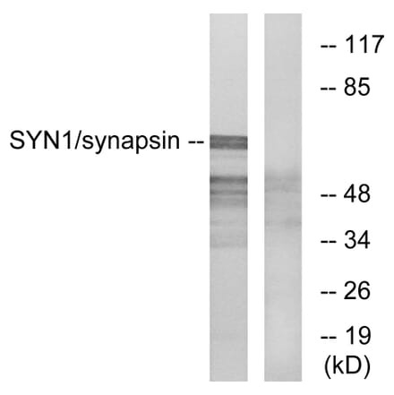 Western Blot - Anti-Synapsin Antibody (B7233) - Antibodies.com