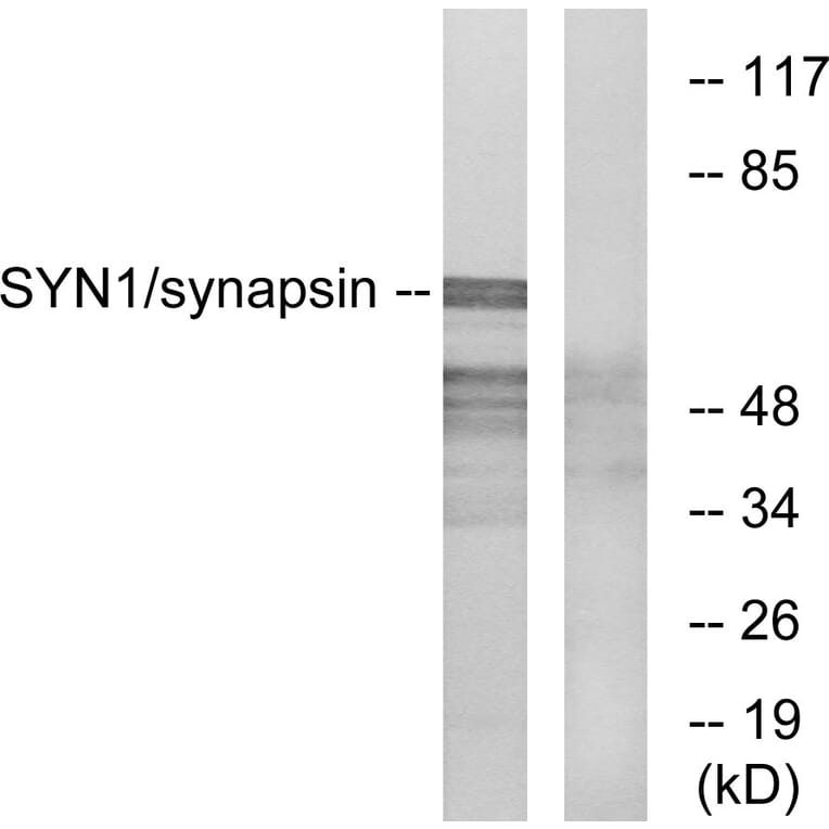 Western Blot - Anti-Synapsin Antibody (B7233) - Antibodies.com