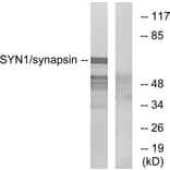 Western Blot - Anti-Synapsin Antibody (B7233) - Antibodies.com