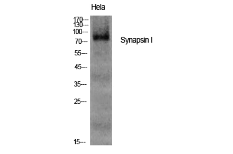 Western Blot - Anti-Synapsin Antibody (B7233) - Antibodies.com