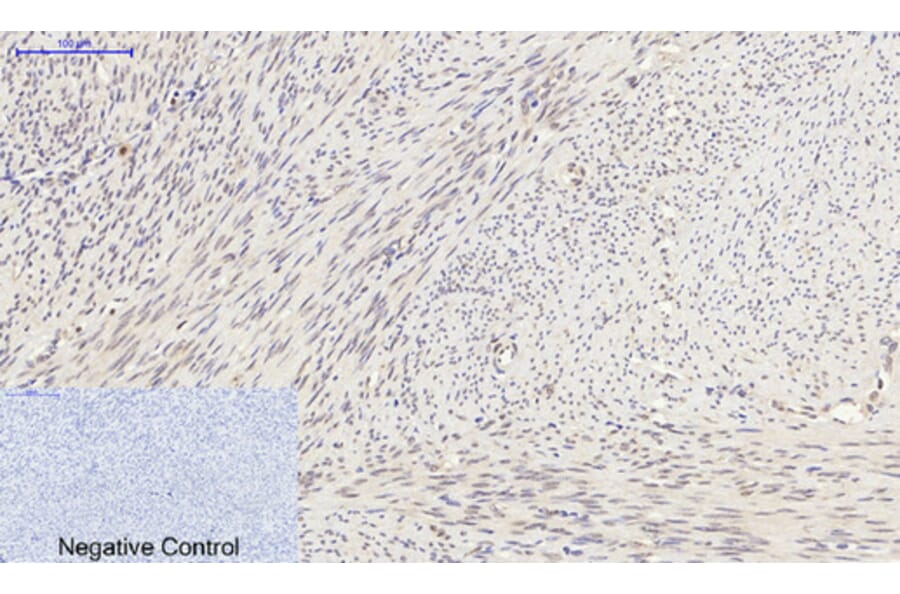 Immunohistochemistry - Anti-Synapsin Antibody (B7233) - Antibodies.com