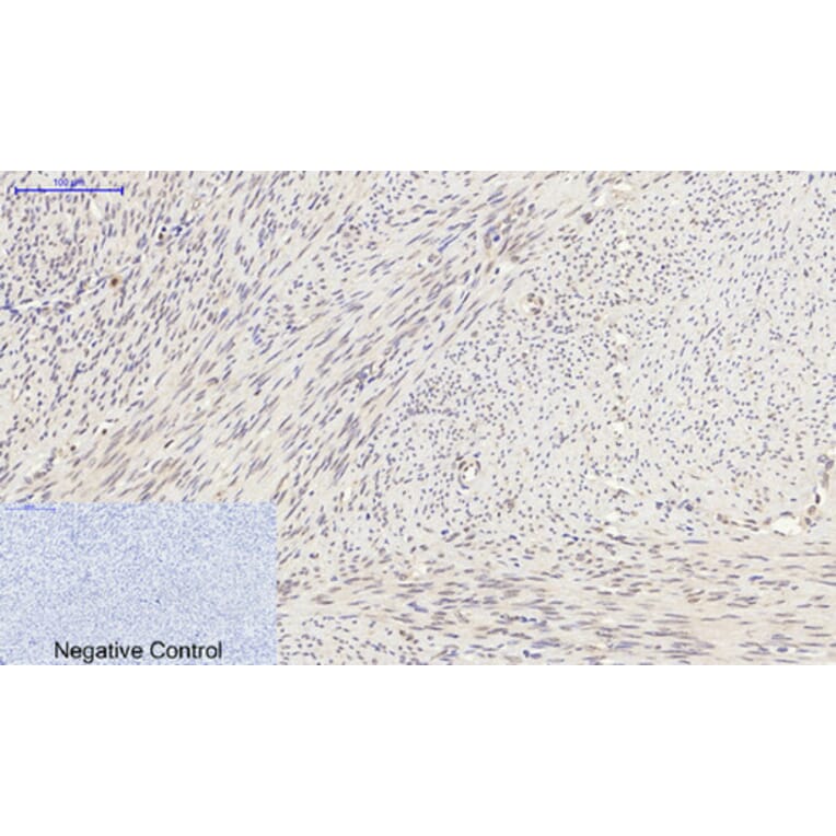 Immunohistochemistry - Anti-Synapsin Antibody (B7233) - Antibodies.com