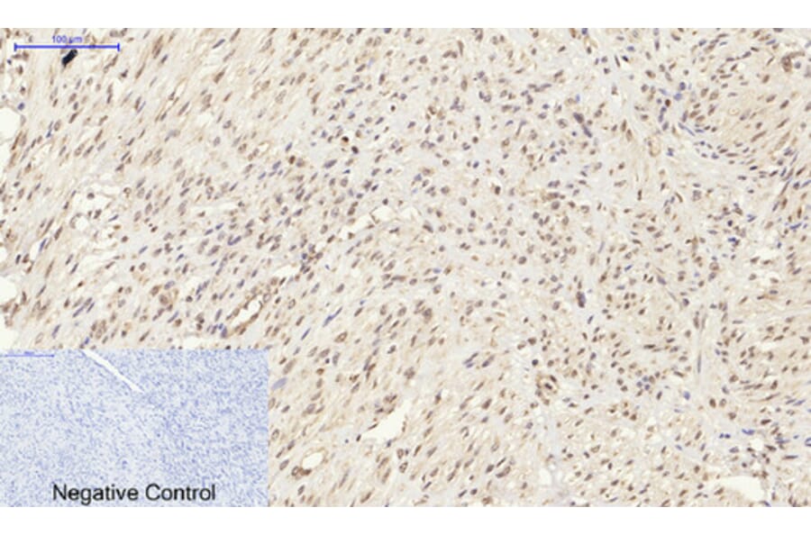 Immunohistochemistry - Anti-Synapsin Antibody (B7233) - Antibodies.com