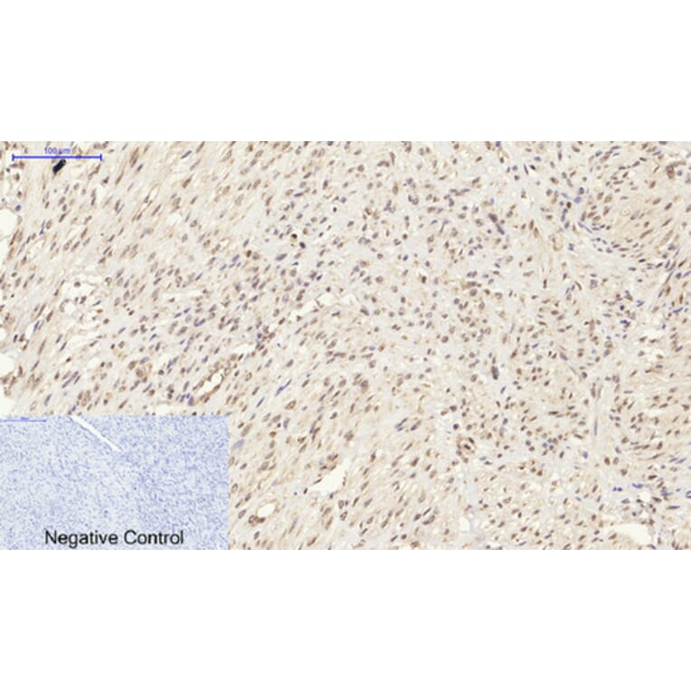 Immunohistochemistry - Anti-Synapsin Antibody (B7233) - Antibodies.com
