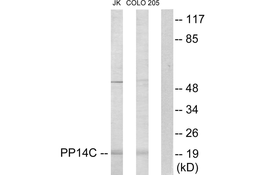 Western Blot - Anti-PPP1R14C Antibody (C11380) - Antibodies.com