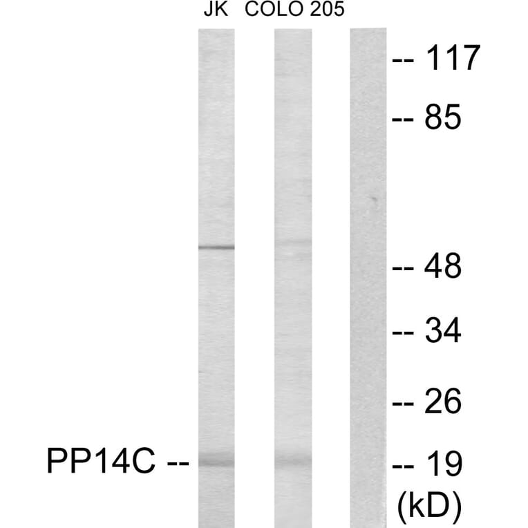 Western Blot - Anti-PPP1R14C Antibody (C11380) - Antibodies.com