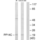 Western Blot - Anti-PPP1R14C Antibody (C11380) - Antibodies.com