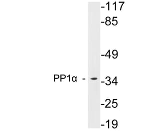 Western Blot - Anti-PP1alpha Antibody (R12-2316) - Antibodies.com