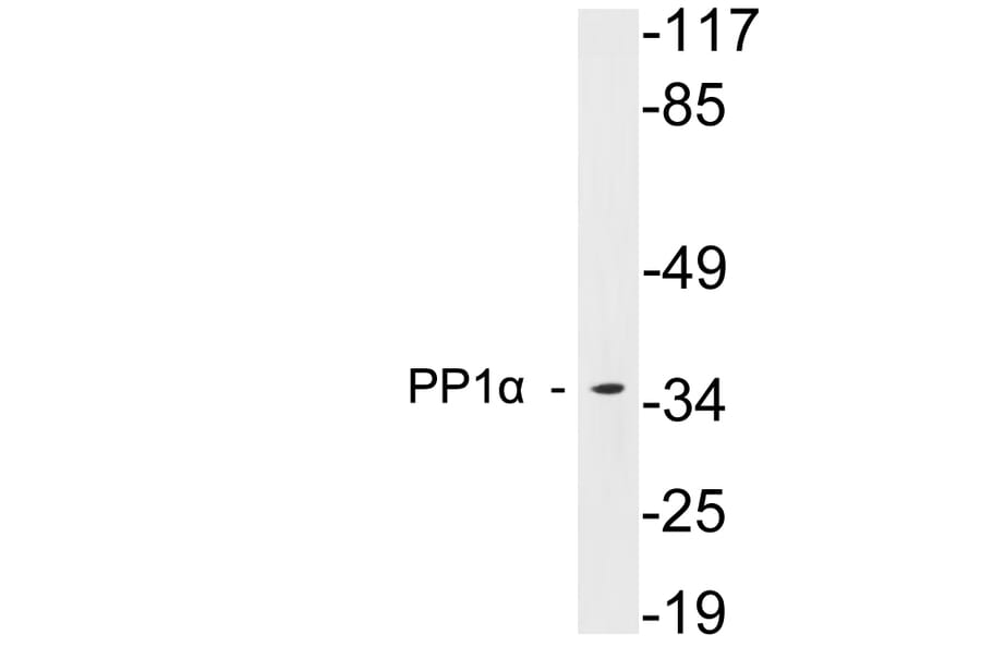 Western Blot - Anti-PP1alpha Antibody (R12-2316) - Antibodies.com