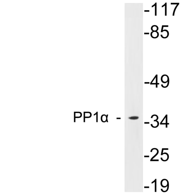 Western Blot - Anti-PP1alpha Antibody (R12-2316) - Antibodies.com