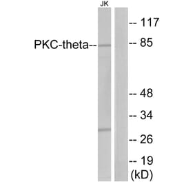 Western Blot - Anti-PKC thet Antibody (B7197) - Antibodies.com