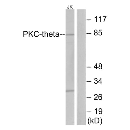 Western Blot - Anti-PKC thet Antibody (B7197) - Antibodies.com