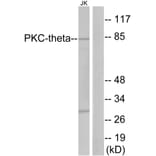 Western Blot - Anti-PKC thet Antibody (B7197) - Antibodies.com