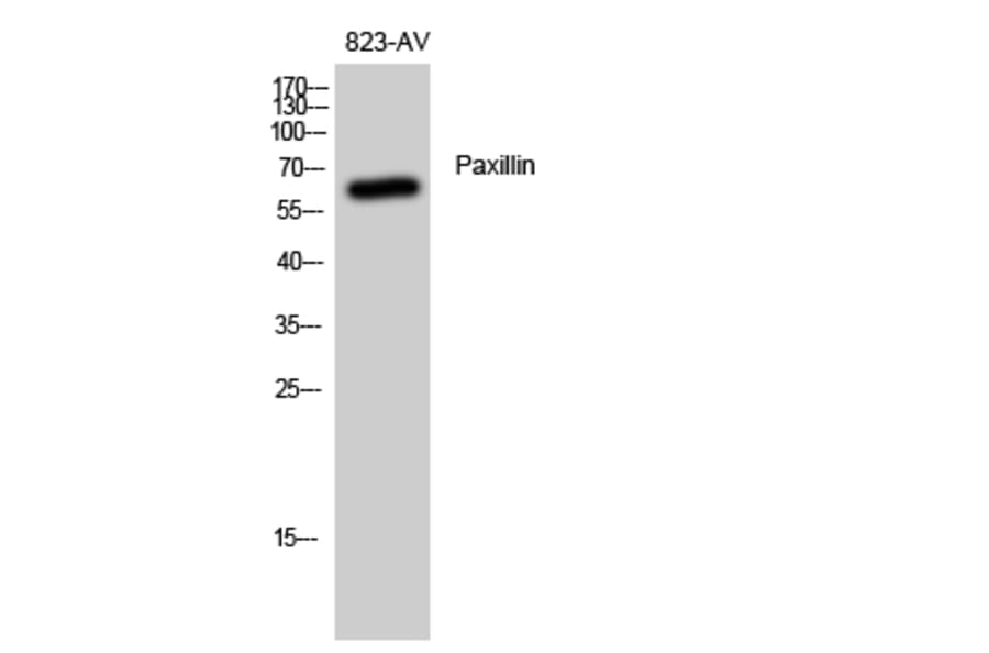 Western Blot - Anti-Paxillin Antibody (B8218) - Antibodies.com