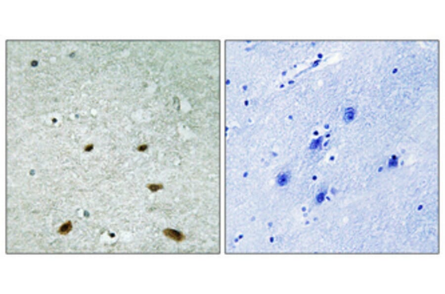 Immunohistochemistry - Anti-p38 MAPK Antibody (B7178) - Antibodies.com
