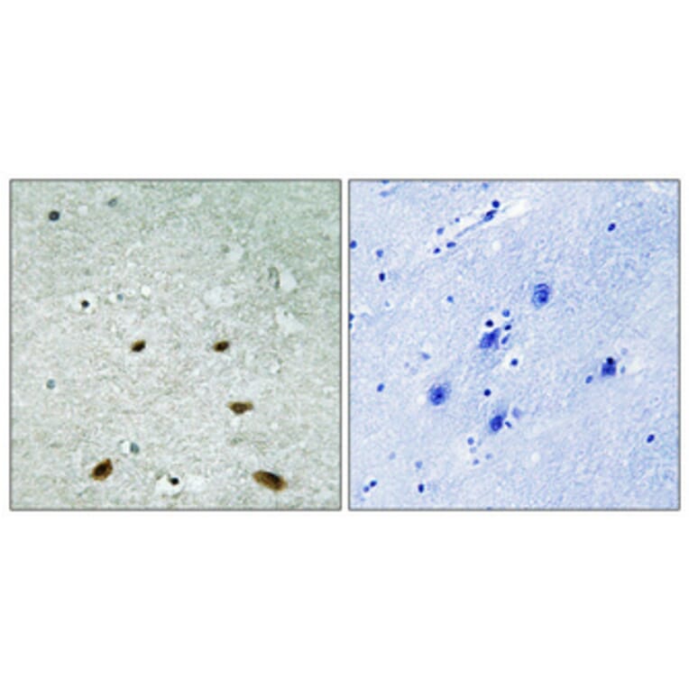 Immunohistochemistry - Anti-p38 MAPK Antibody (B7178) - Antibodies.com