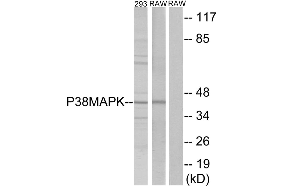 Western Blot - Anti-p38 MAPK Antibody (B7179) - Antibodies.com