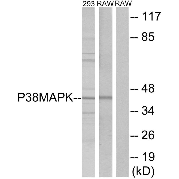 Western Blot - Anti-p38 MAPK Antibody (B7179) - Antibodies.com