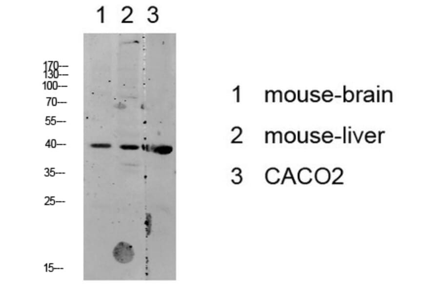 Western Blot - Anti-p38 MAPK Antibody (B7179) - Antibodies.com