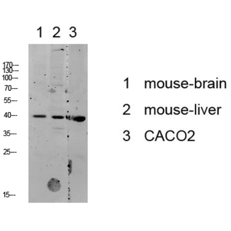 Western Blot - Anti-p38 MAPK Antibody (B7179) - Antibodies.com