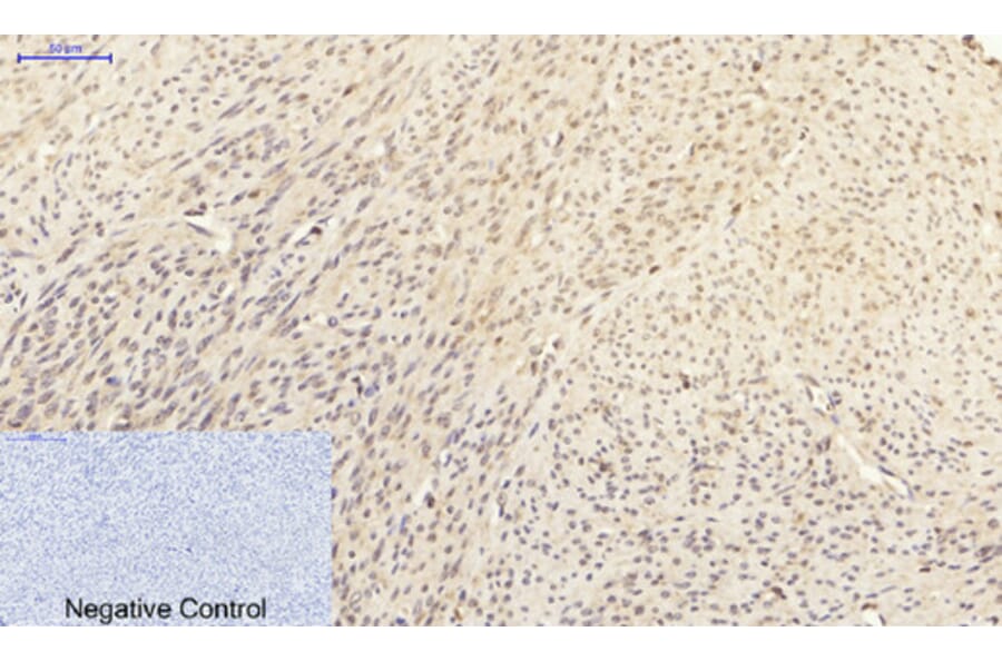 Immunohistochemistry - Anti-p38 MAPK Antibody (B7179) - Antibodies.com