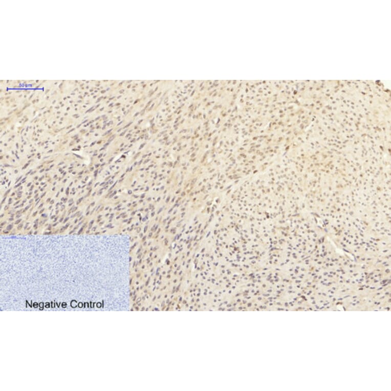Immunohistochemistry - Anti-p38 MAPK Antibody (B7179) - Antibodies.com